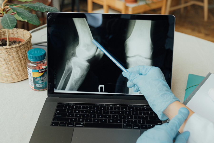 Best Knee Brace for Arthritic Knees